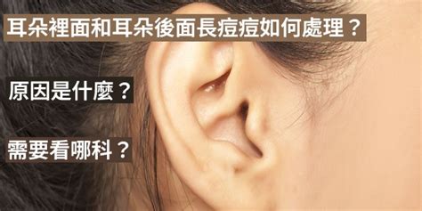 耳朵長痘痘看哪科|耳朵里长痘：症状、原因、治疗和预防